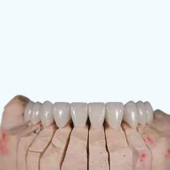 hector 1100MPa multiayer zirconia